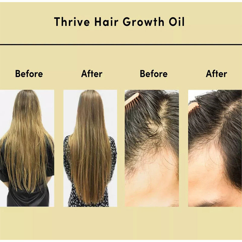 Hair fall Hair Regrowth Oil